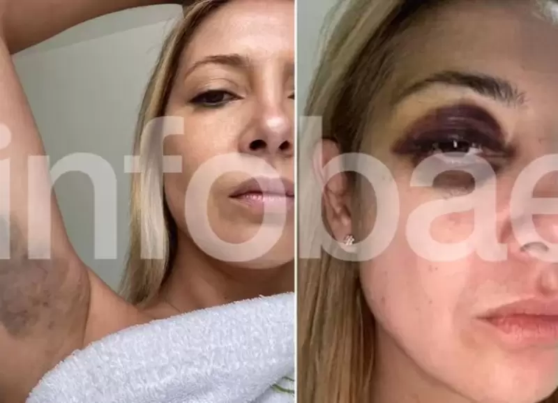 Las fotos de Fabiola Yaez que estn en la causa judicial contra Alberto Fernndez por violencia de gnero