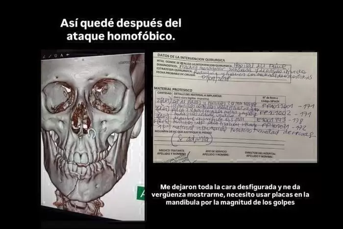 Las publicaciones de Juan en sus redes sociales.
